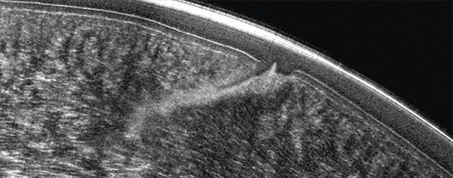 Resolution Box Image