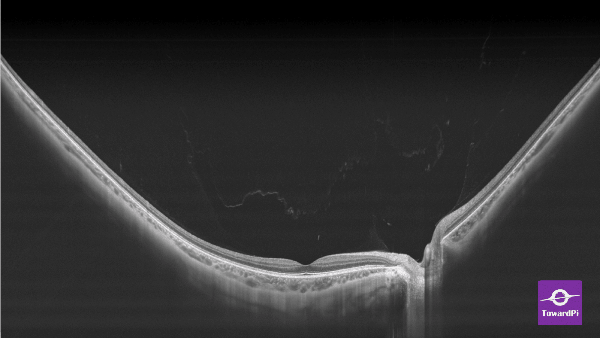Resolution Box Image