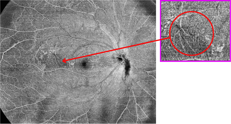 Resolution Box Image