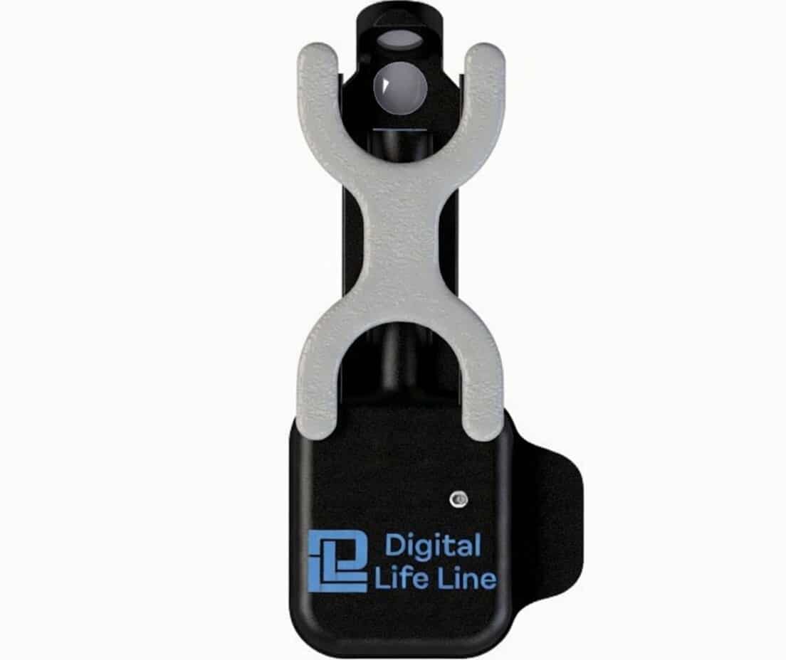 Digital-lifeline®MIDAS  AI Cataract Index Analyzer（白內障分析儀)