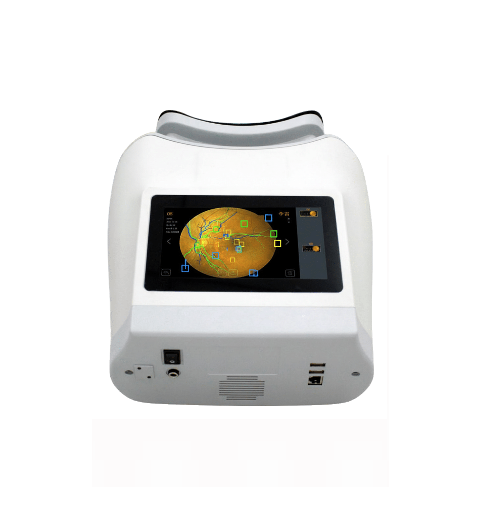 SysEye®Kestrel 300 – Portable Fundus Camera